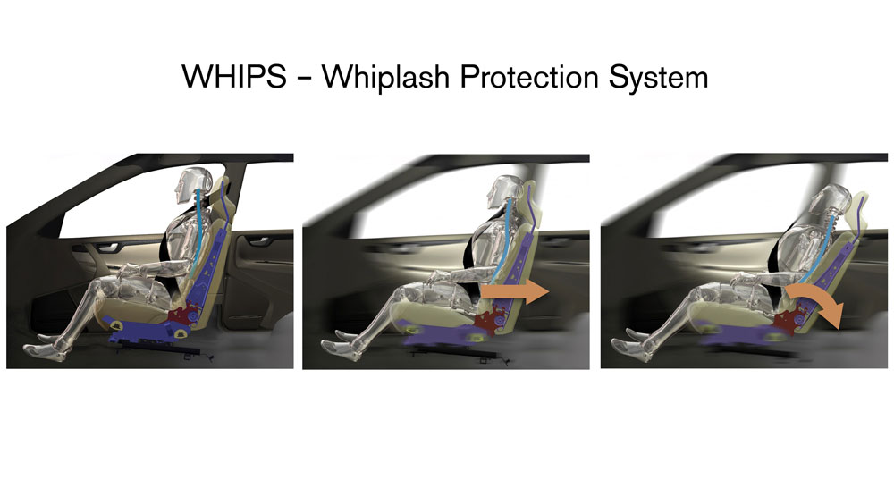 Whiplash là gì?